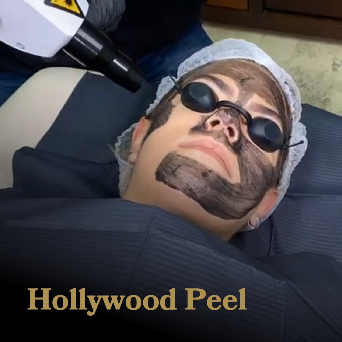 Hollywood Peel