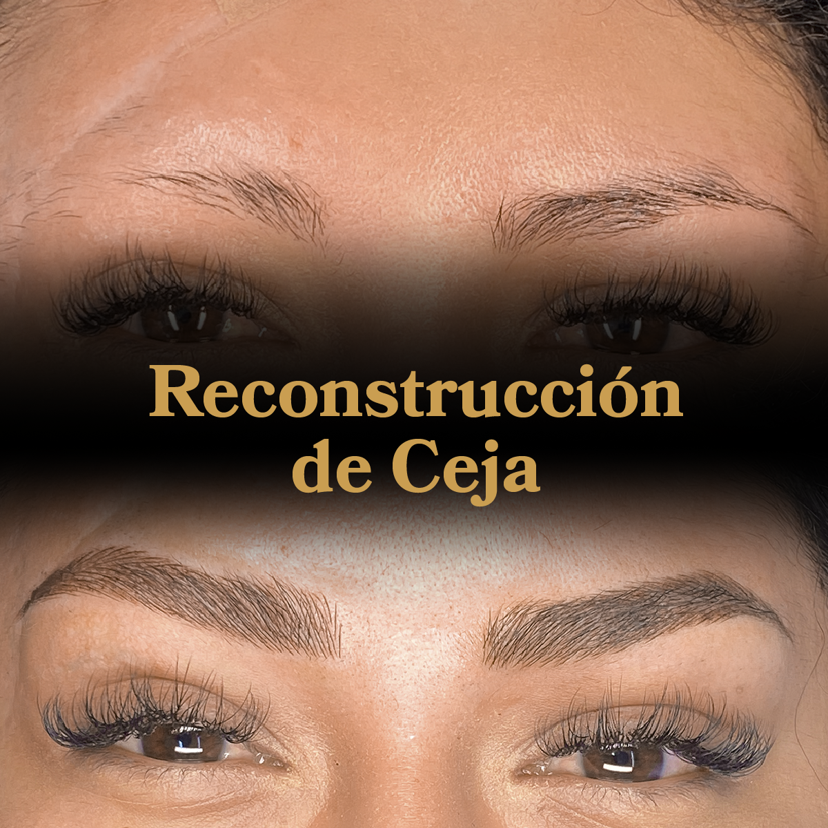 Reconstrucción de Cejas